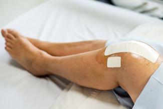 Image: Knees and lower legs of a woman on a hospital bed after a knee replacement surgery