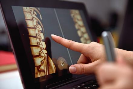 Image: Fingers pointing at a Bone Scan Image