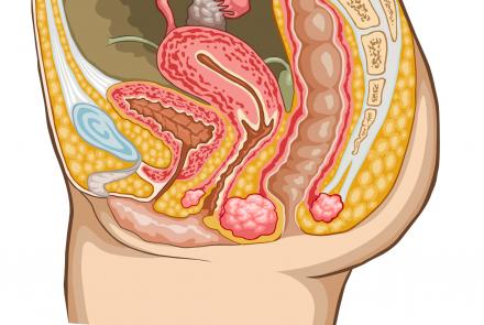 Anatomical Image of Ovaries in human body