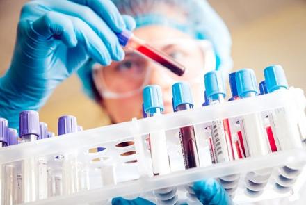 An image of a set of test vials and a hand holding one of these test tubes in a blue gloved hand