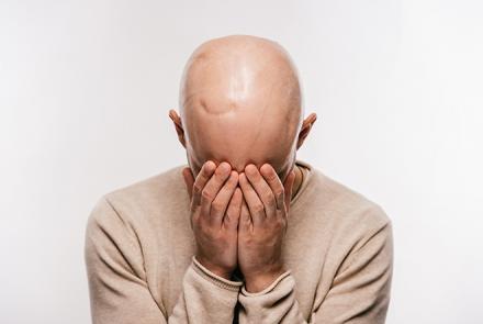 Cancer patient feeling distressed and covering face