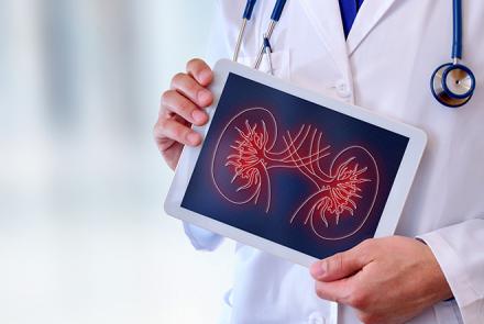 Partial image of a person in a white doctor coat with stethoscope around the neck holding an image of kidney